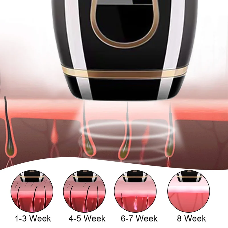 Laser Hair Removal Machine Week Procedure